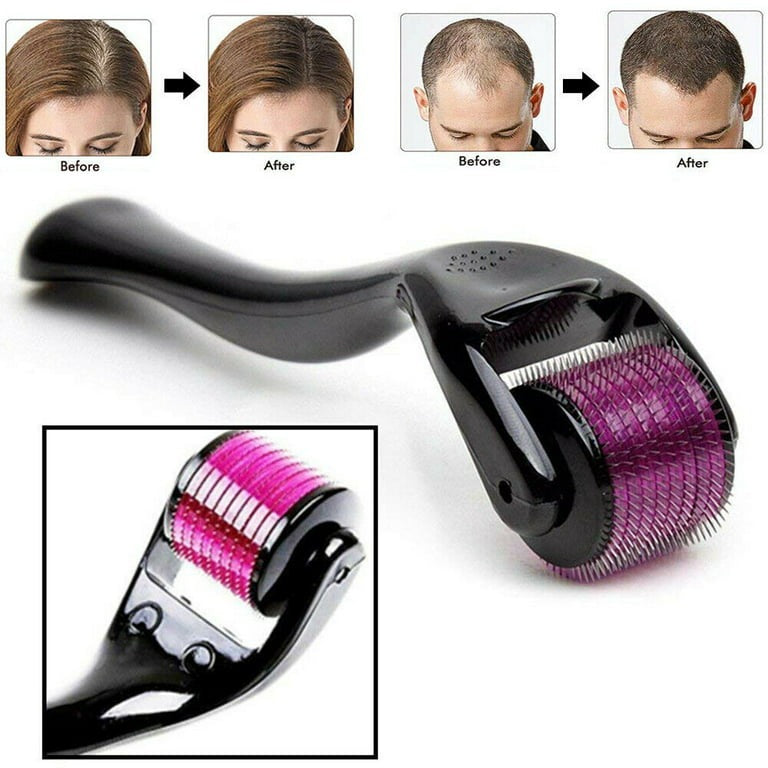 Derma Roller for Hair and Skin Therapy